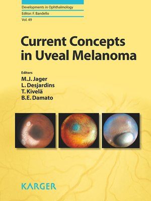 cover image of Current Concepts in Uveal Melanoma